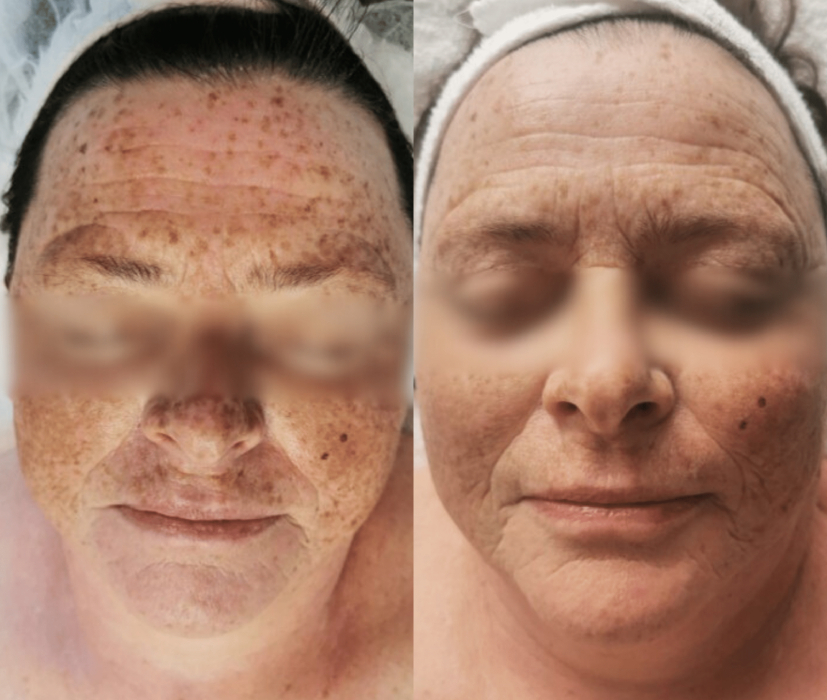 Porcelaine el «Efecto borrador» de Bloomea